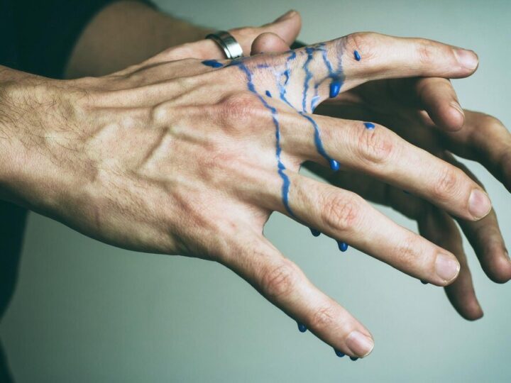 Uszkodzenie nerwu promieniowego: przyczyny, objawy i sposoby leczenia